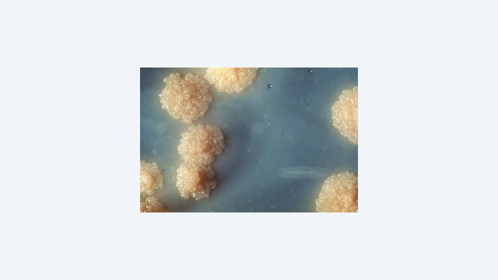 Nanopartícula de ferro elimina tuberculose em camundongos em 30 dias