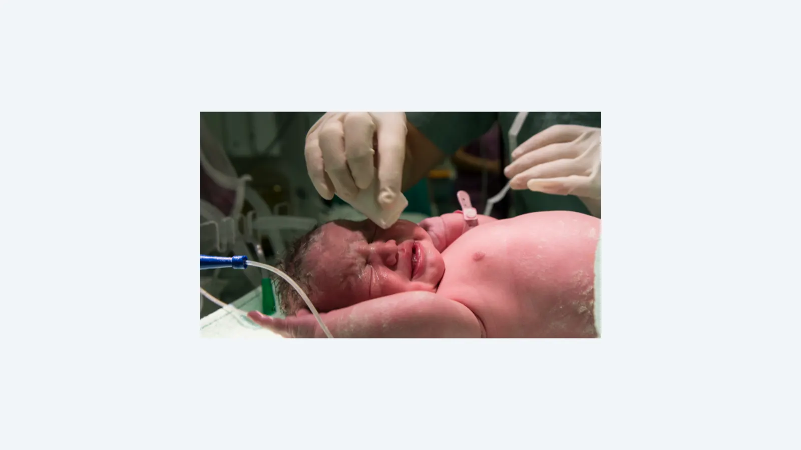 IA revoluciona avaliação da dor em bebês na UTI neonatal