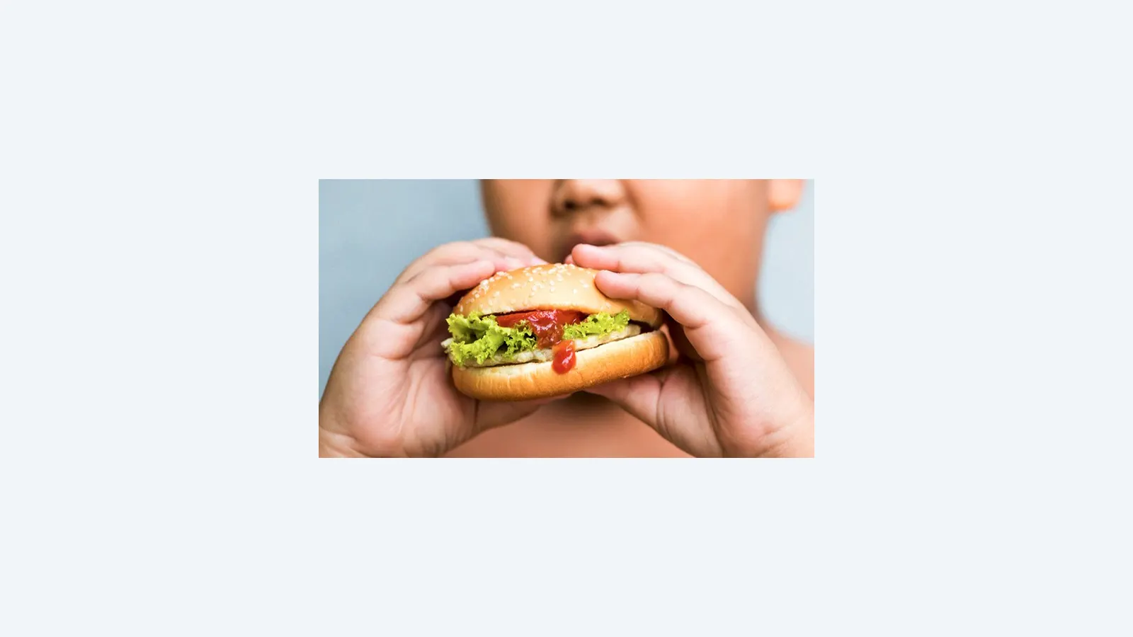 Mato Grosso do Sul registra estabilidade na obesidade infantil e intensifica ações preventivas