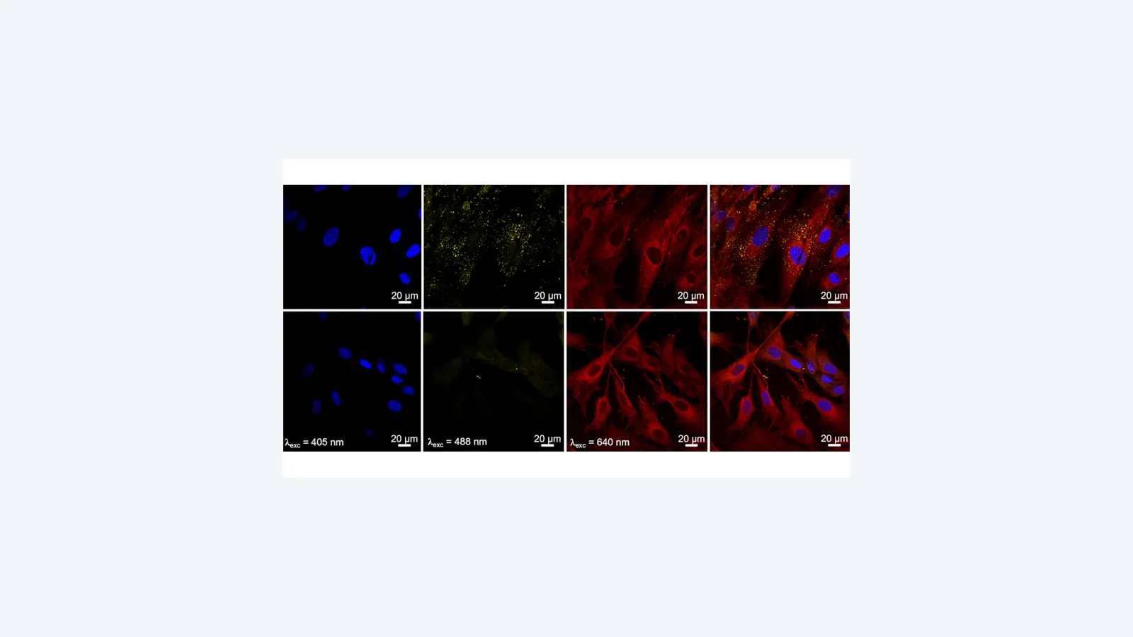 Nanopartículas de hidroxiapatita avançam em imagem médica e câncer