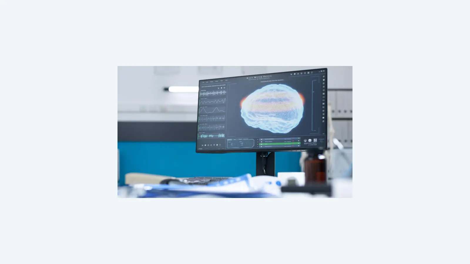 Estudo inova na reabilitação pós-AVC com neuromodulação e fisioterapia