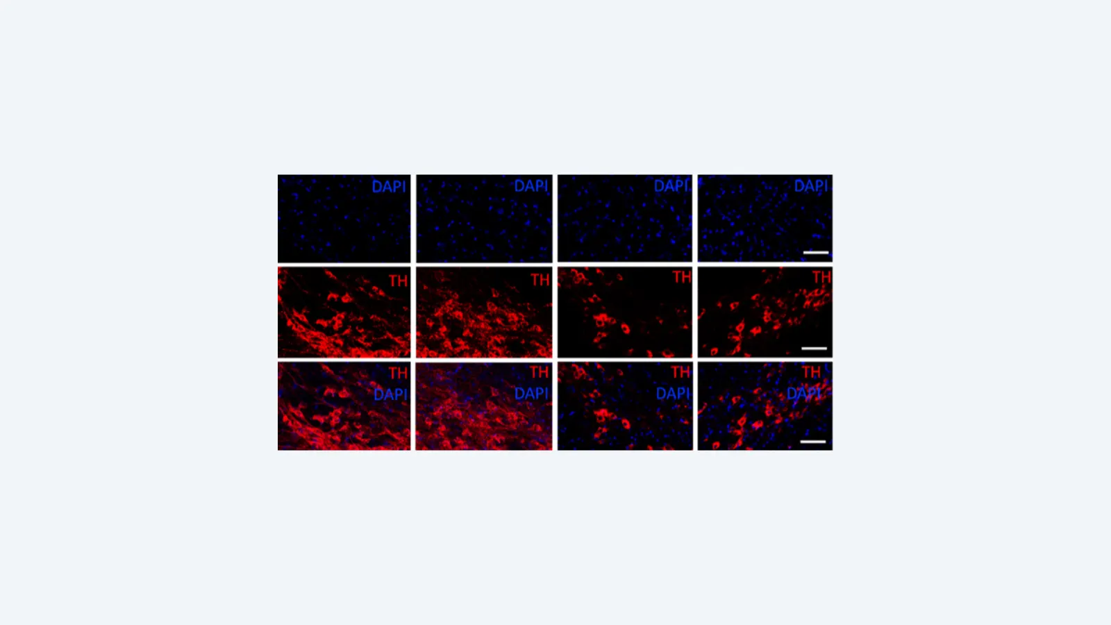 Peptídeo anti-inflamatório mostra promissor efeito contra Parkinson em estudo