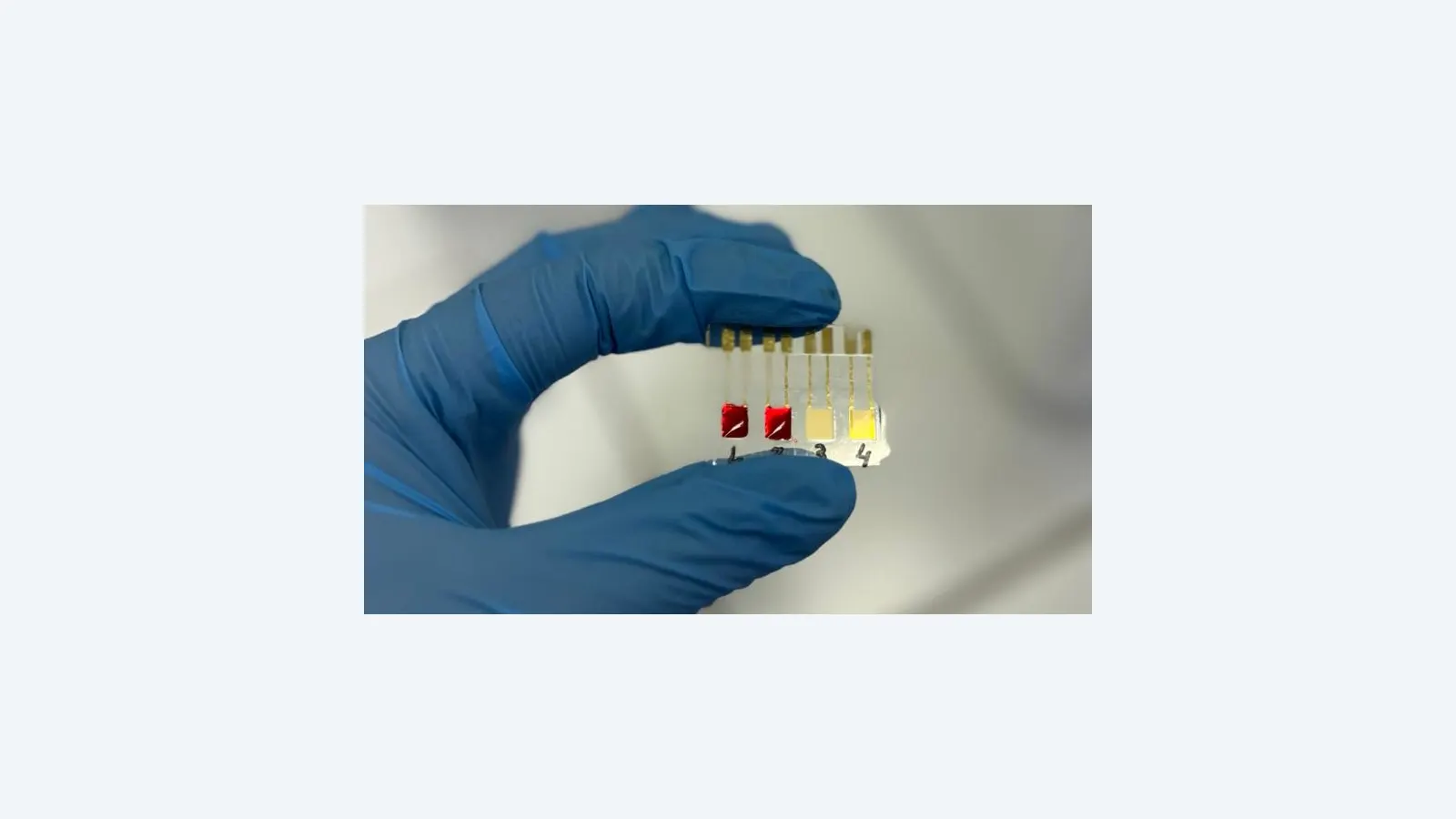 Biossensor inovador detecta câncer de pâncreas em estágio inicial com rapidez