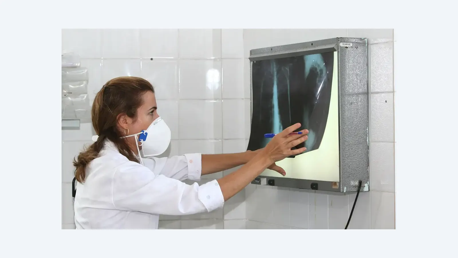 OMS destaca testes rápidos para acelerar diagnóstico da tuberculose