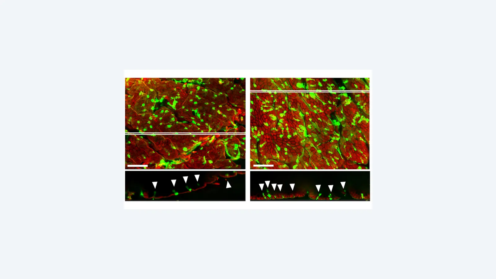 Estudo revela como perda de microbiota afeta proteção intestinal