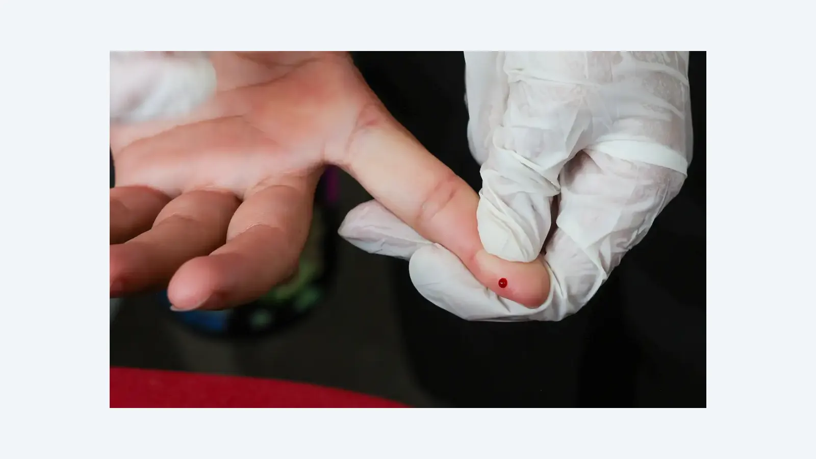 SUS inicia teste rápido para diagnóstico precoce da dengue
