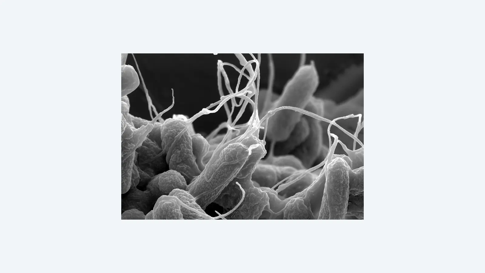 FAPESP e parceiros lançam edital para combater resistência antimicrobiana na América do Sul